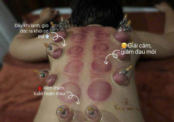Massage Giác Hơi - Cạo Gió 